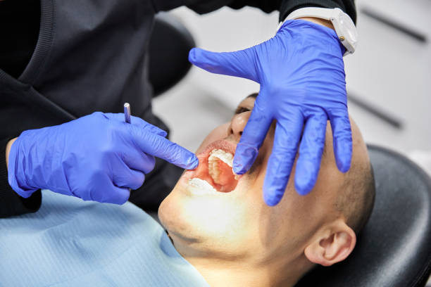 Best Tooth Pain Emergency Relief  in Chesapeake, OH